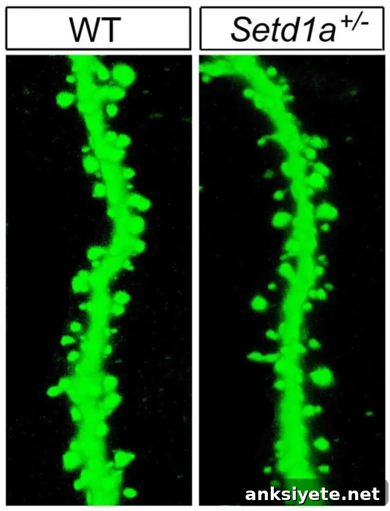 Study Finds Schizophrenia Gene Linked to Cognitive Impairment 2 This shows dendritic spines