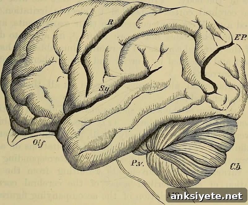 The image shows a brain