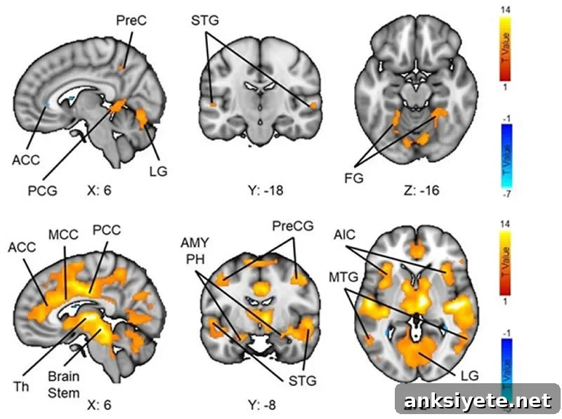 This shows brain scans from the study