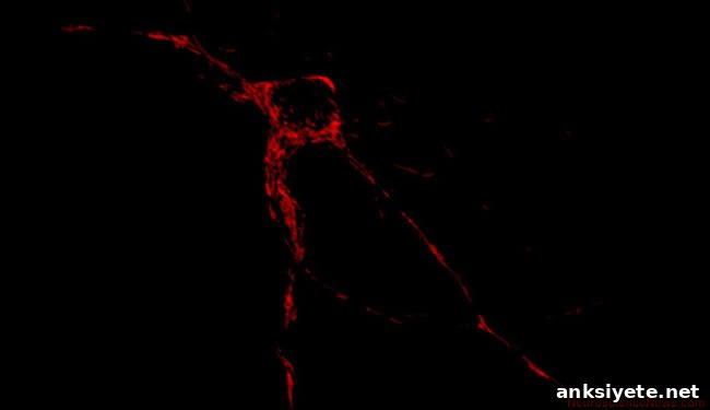 An image of a neuron is shown. 