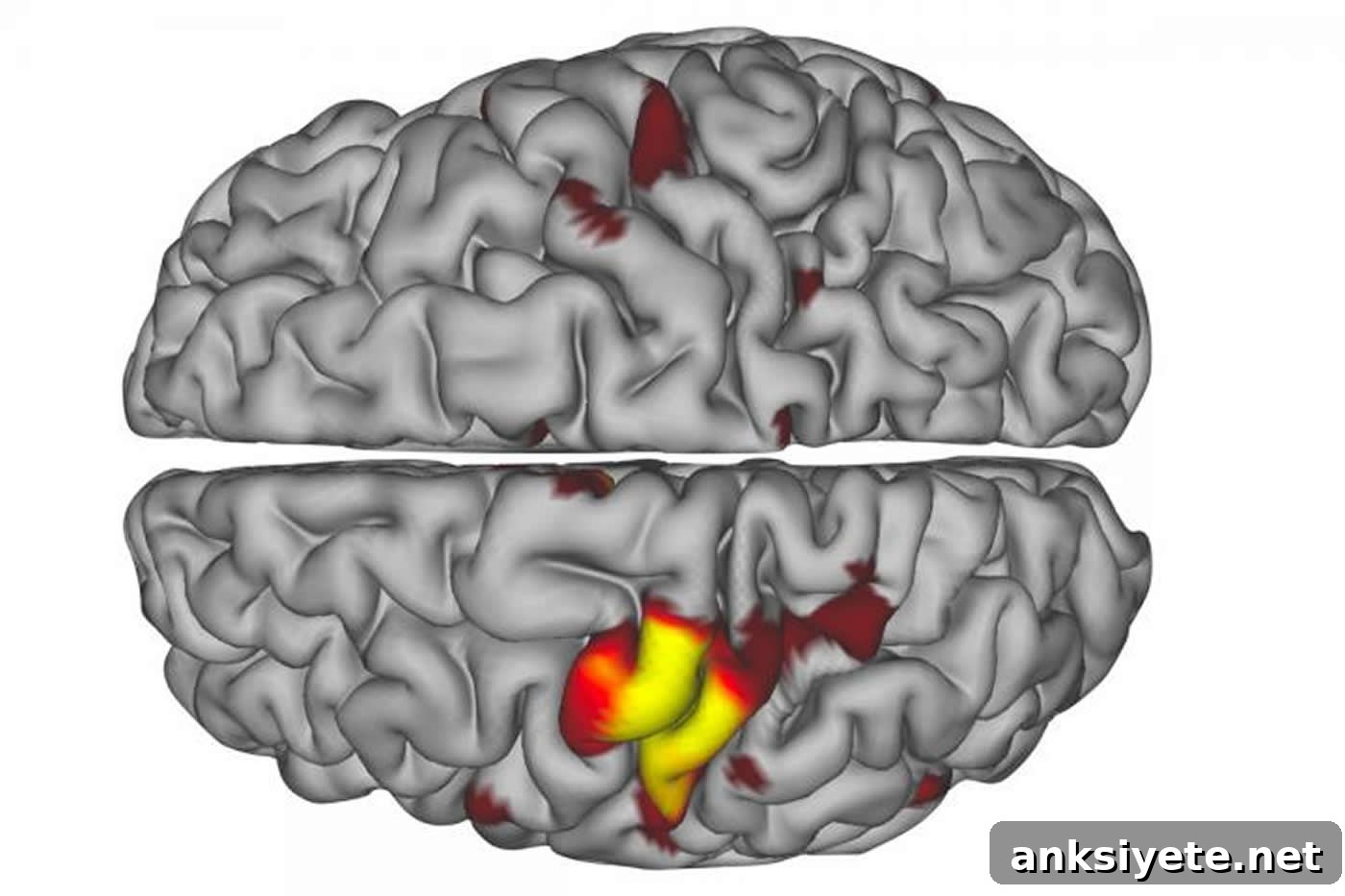 This shows brain scans from the study