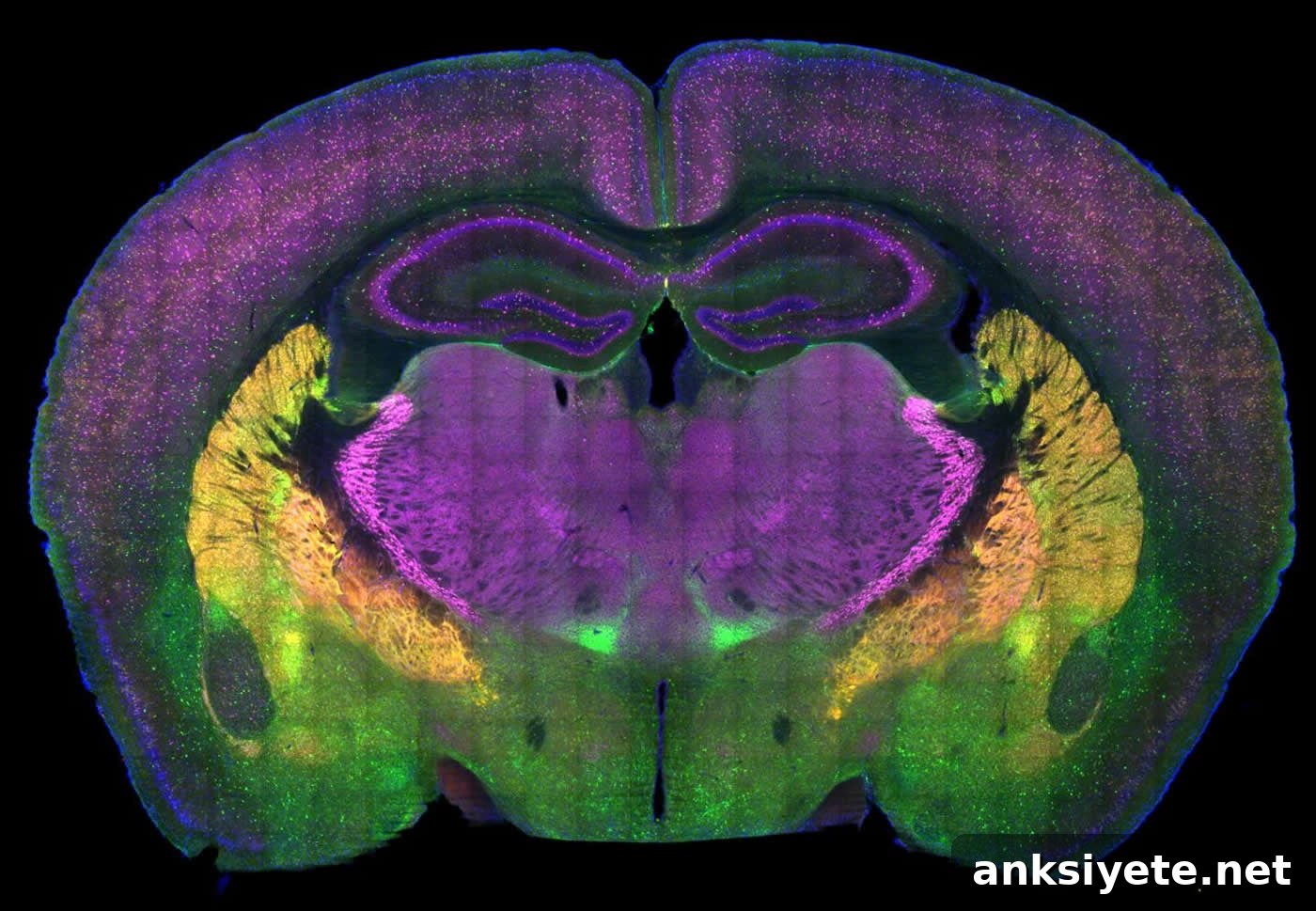 This shows a brain slice