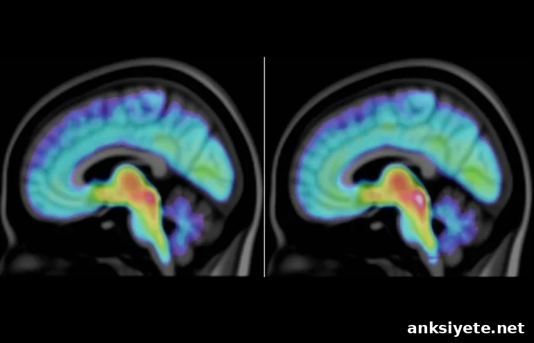 This shows brain scans from the study