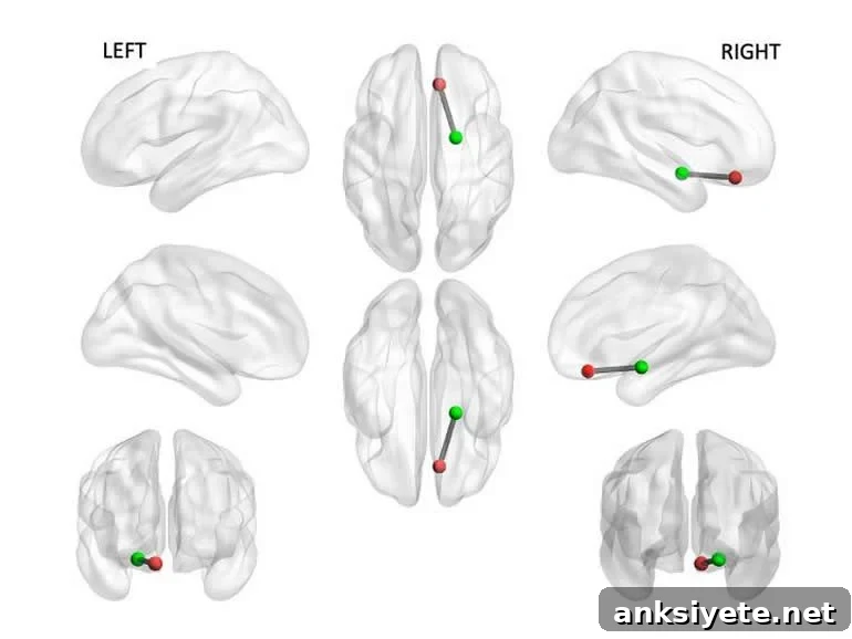 This shows brain scans from the study