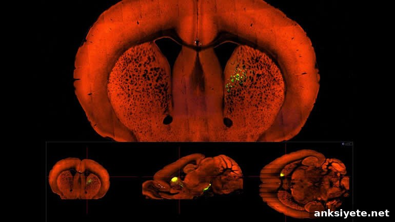 This shows the striatum