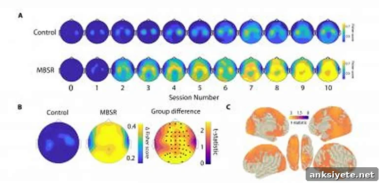 This is an EEG print out from the study