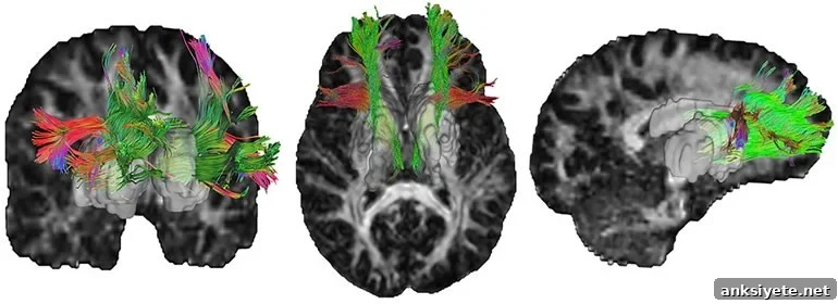 This shows brain scans from the study