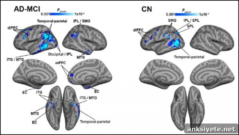 This shows brain scans from the study