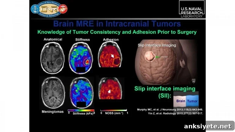 This shows brain scans from the study