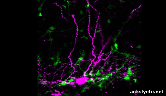 Image of neurons is shown. Caption describes well.