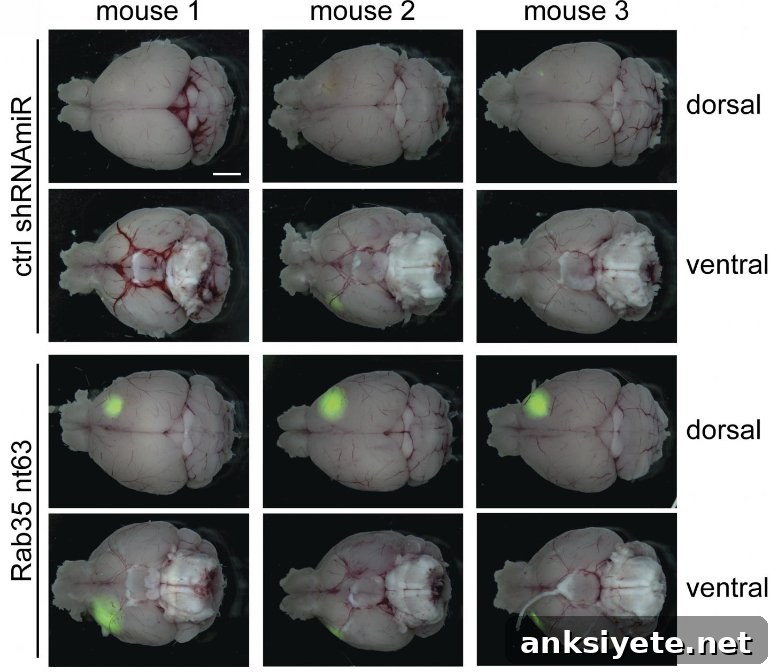 This shows different mouse brains with and without Rab35