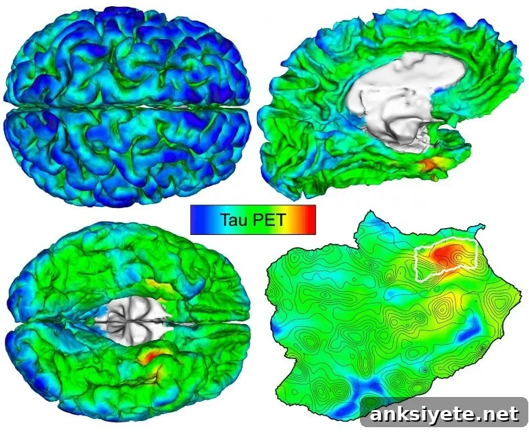 This shows brain scans from the study