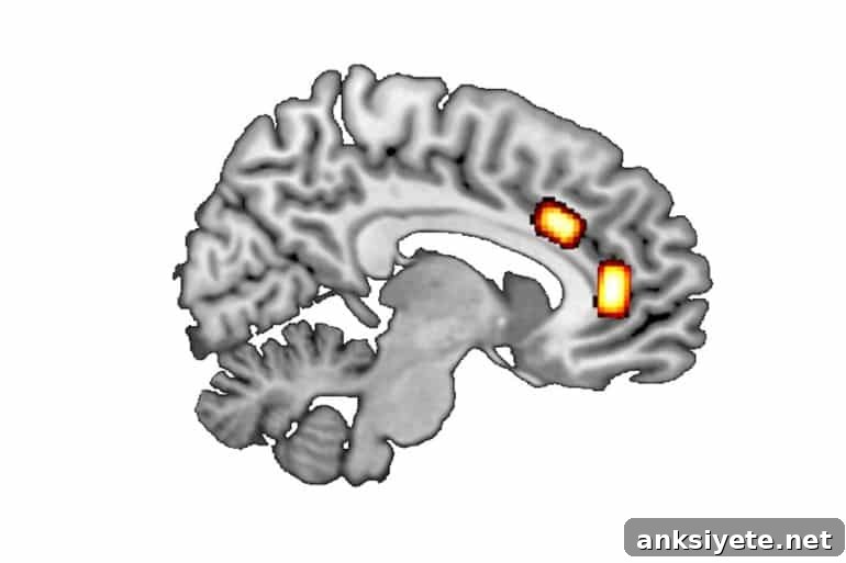 This shows a brain scan from the study