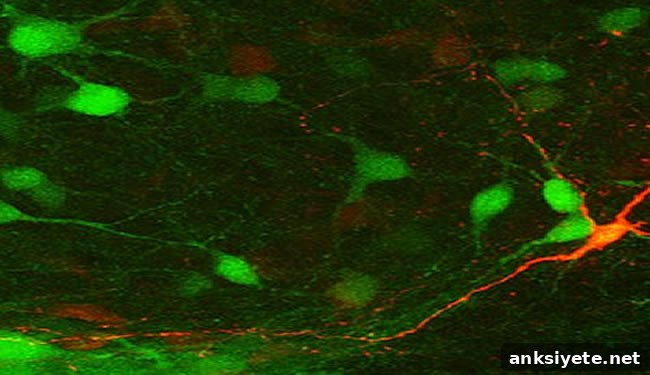 Interneurons Dravet Syndrome An image of interneurons are shown.