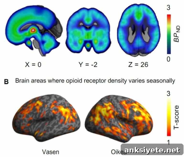 This shows brain scans from the study