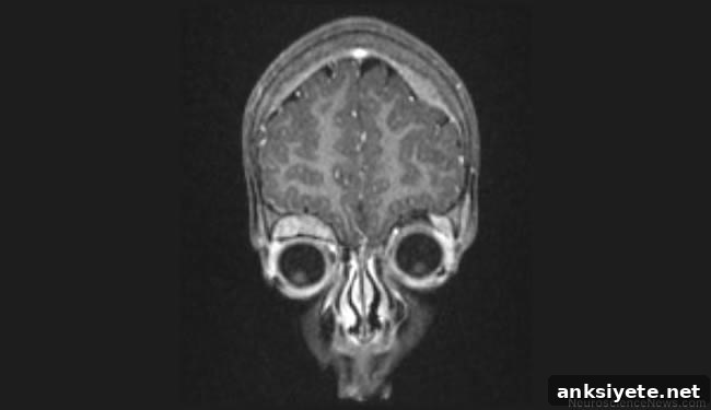 MRI image showing a neuroblastoma in the brain is shown.