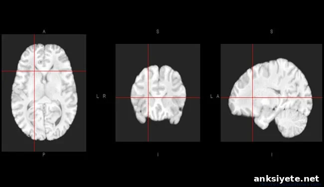 Three human brain atlas views using MRI data are shown.