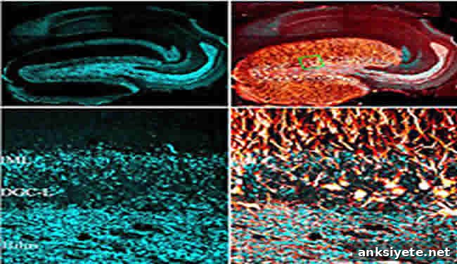Epileptic Dentate Gyrus Granule Cells Confocal microscopic images of dentate gyrus granule cells involved in epilepsy are shown. Caption describes well.