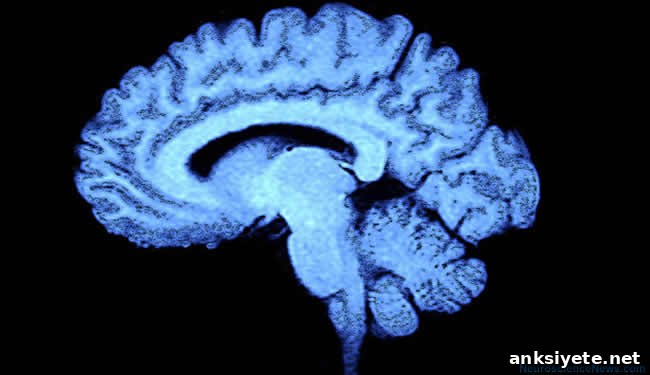 A brain is shown.