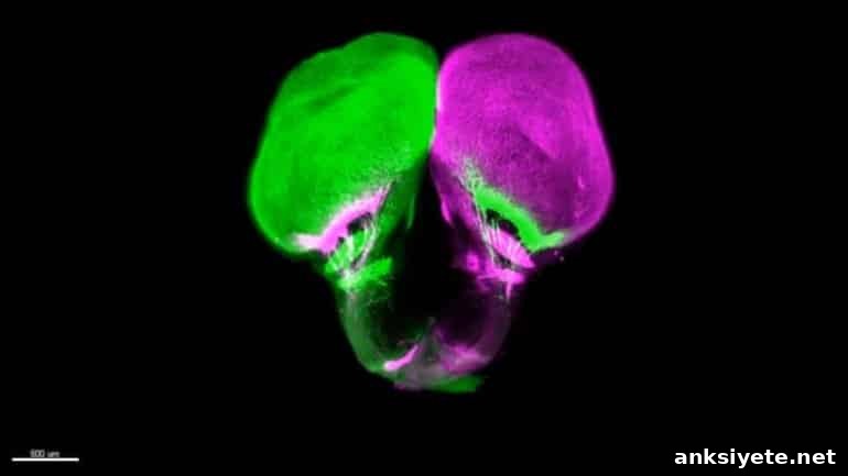 This shows a gar brain