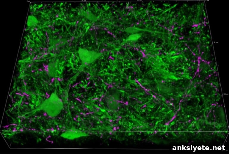 This shows amygdala neurons