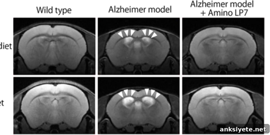 This shows brain scans from the study