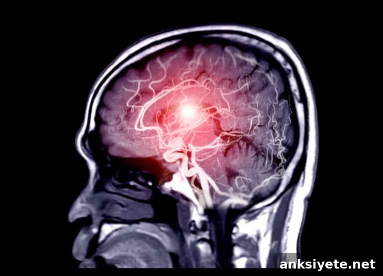 This shows a brain scan