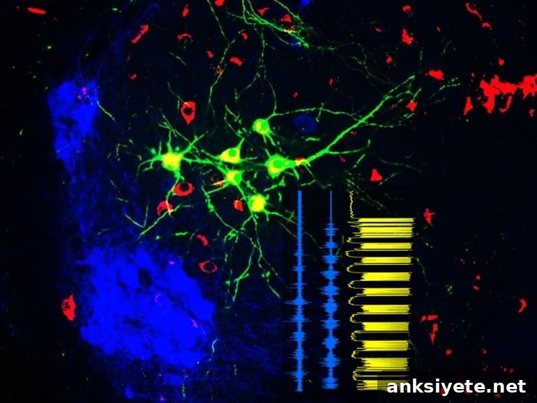 This shows spincerebellar neurons