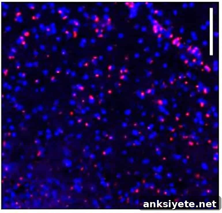 This shows hepcidin expression in the brain