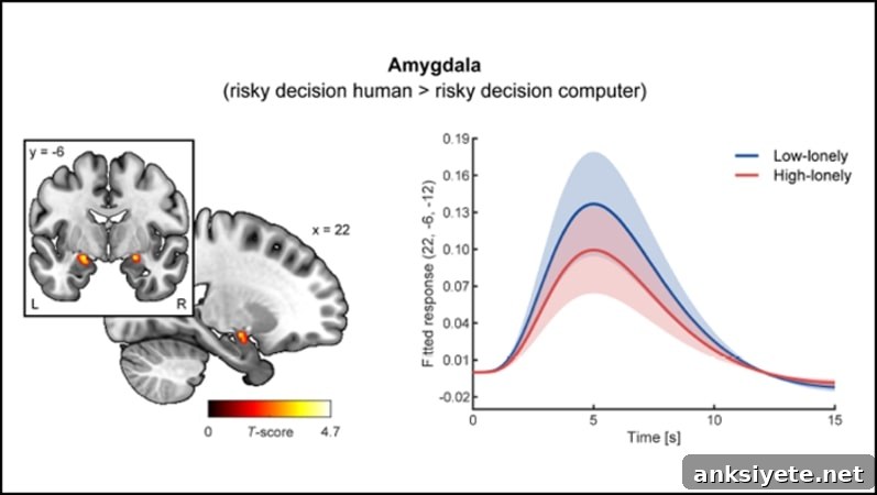 This shows a graph and the location of the amygdala in the brain