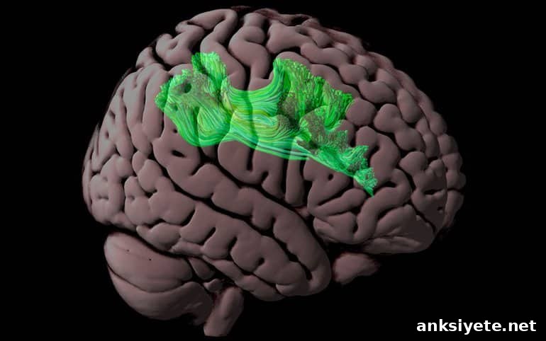 This shows the white matter tract in the brain's reading network