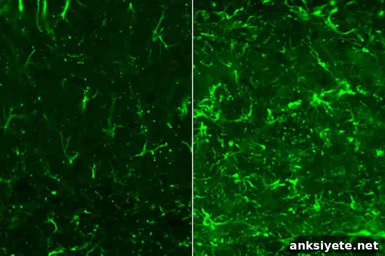 This shows astrocytes