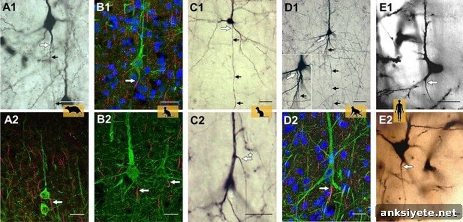 This shows human and non-human primate neurons