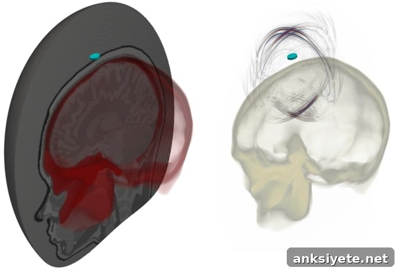 This shows the images created by ultasound