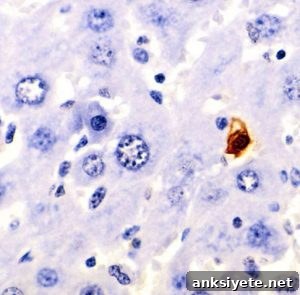 The image shows a section of mouse liver showing an apoptotic cell.