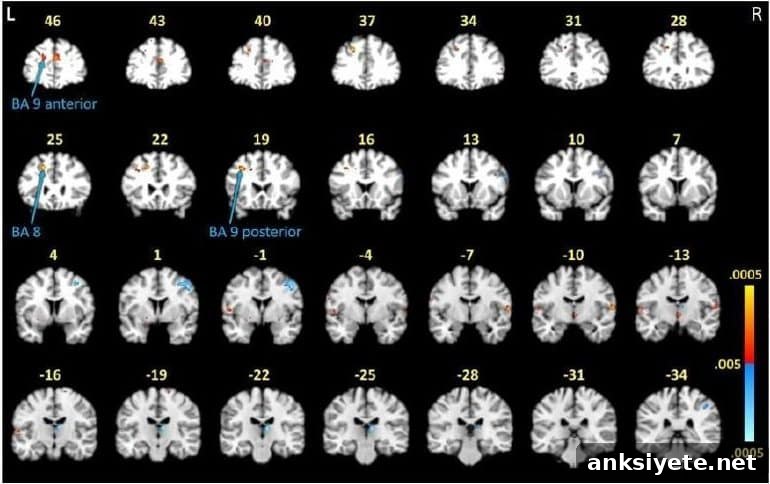 This shows brain scans from the study