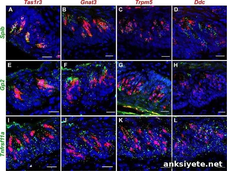 This shows taste cells