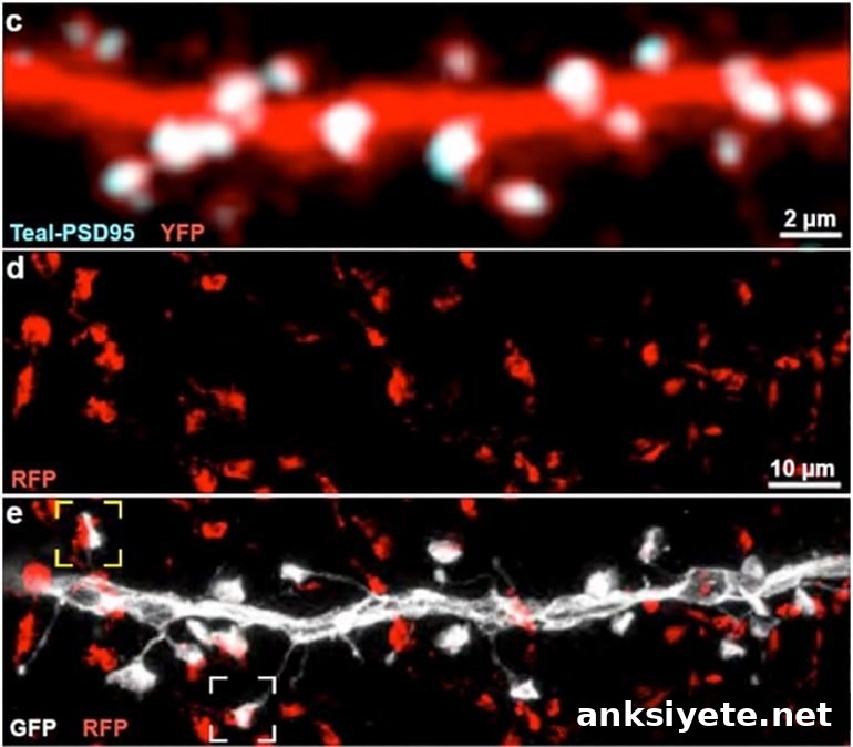 This shows dendrites