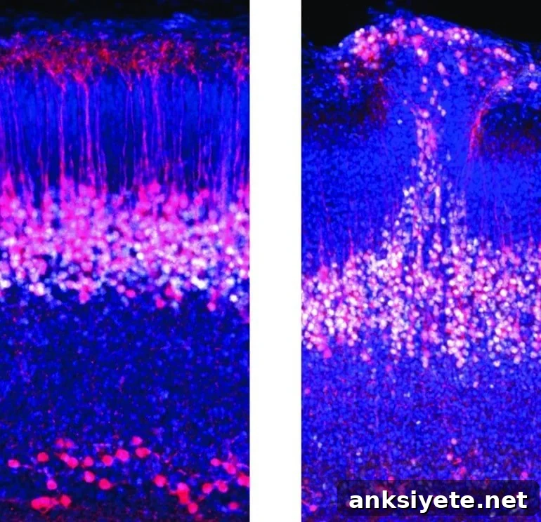 This shows pyramidal neurons
