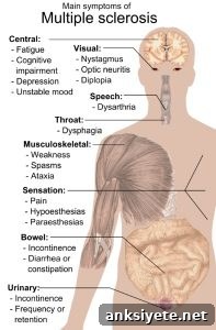 The diagram shows the symptoms of MS and the human body.