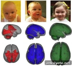 How Breastfeeding Boosts Infant Brain Development 2 The image shows the differences in the brain scans between the breast fed and formula fed babies.