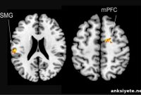 Why Your Brain Chooses Spite Over Friendship