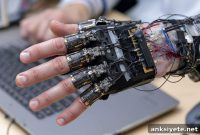 Exoskeleton Decodes Weak Muscle Signals to Treat Hand Paralysis