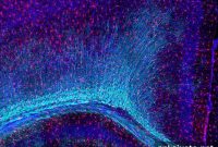 TDP-43 Loss Reduces Microglial Phagocytosis