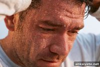 Scientists Identify Genetic Cause of Hyperhidrosis