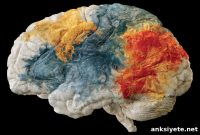 Study Reveals Accelerated Brain Aging Signatures in 9 Conditions