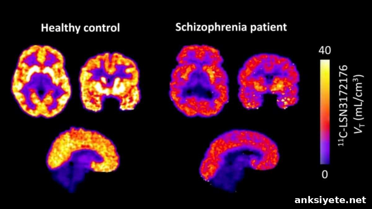 This shows brain scans from the study.