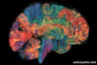 AI Estimates Regional Brain Age to Predict Alzheimer’s Risk
