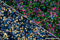 Cell Village Platform Reveals Genes Driving Brain Growth