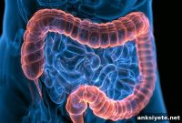 Inflammatory Bowel Disease Raises Anxiety and Depression Risk
